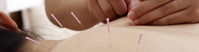 Acupuncture traditionnelle illustration