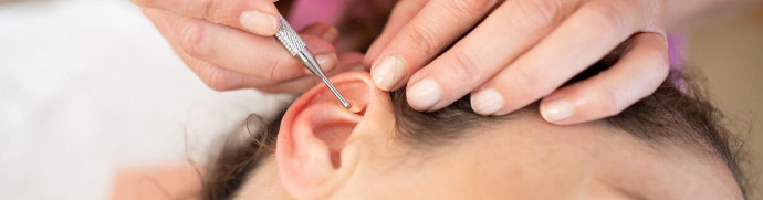 L’auriculothérapie pour gérer le stress illustration